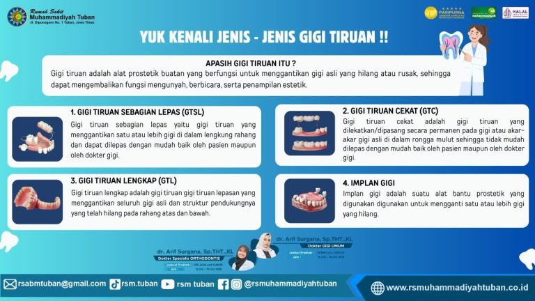 YUK KENALI JENIS – JENIS GIGI TIRUAN !!